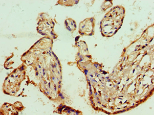 PHAP1 / ANP32A Antibody (aa1-170)