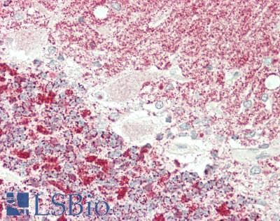 IHC-plus™ Polyclonal Rabbit anti-Human KLC1 / Kinesin Light Chain 1 Antibody (aa389-415, IHC, WB)