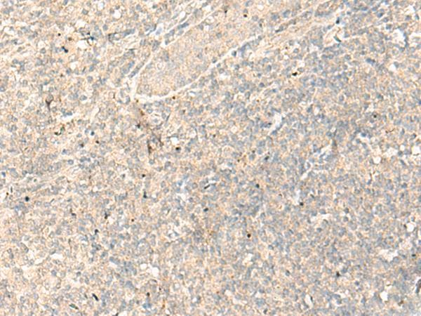 Polyclonal Rabbit anti-Human RGR Antibody (IHC, WB)
