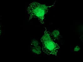 TMOD1 / Tropomodulin 1 Antibody (clone OTI5F8)