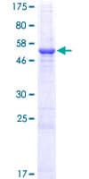 Human RCAN2 / RCN2 Protein (Recombinant GST)