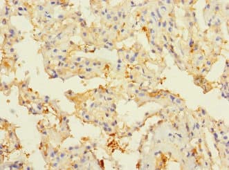 CIR1 Antibody