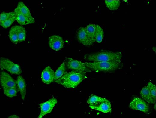 CRTC1 / MECT1 / TORC1 Antibody