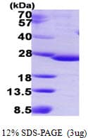 Human IDNK Protein (Recombinant His)