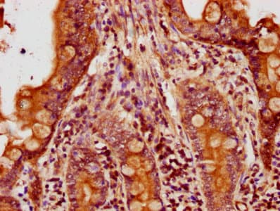 ACTB / Beta Actin Antibody