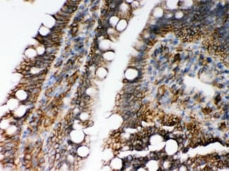 HLA-C Antibody