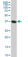 NMI Antibody (clone 9E8)