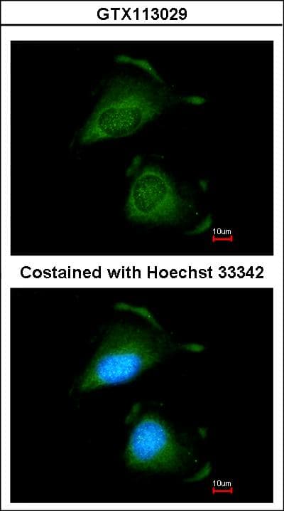 IHC-plus™ TRAF6 Antibody