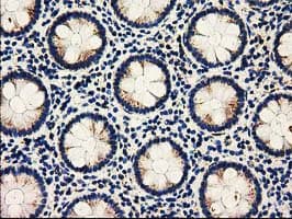 Monoclonal Mouse anti-Human AK3 / Adenylate Kinase 3 Antibody (clone OTI6G4, IHC, WB)