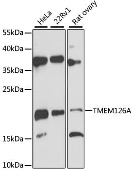 Polyclonal Rabbit anti-Human TMEM126A Antibody (WB)