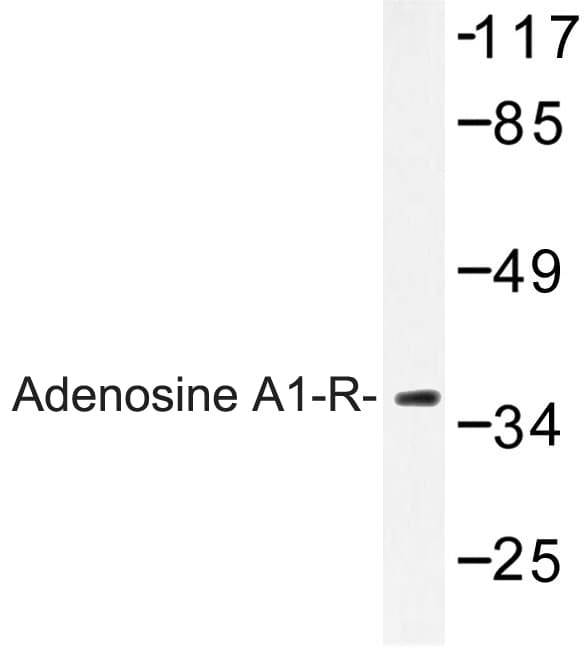 IHC-plus™ ADORA1 / Adenosine A1 Receptor Antibody (Asp326)