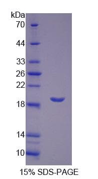 Mouse LTA4H / LTA4 Protein (Recombinant His-S)