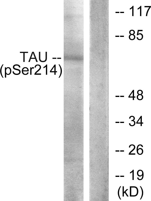 Polyclonal Rabbit anti-Human MAPT / Tau Antibody (phospho-Ser214, WB)