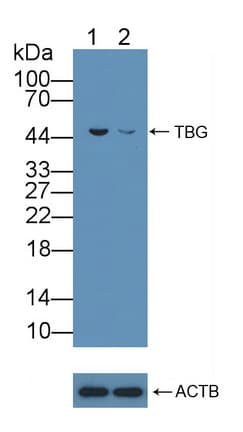 SERPINA7 / TBG Antibody (aa128-415)