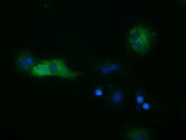 SULT2A1 / Sulfotransferase 2A1 Antibody (clone OTI4D7)