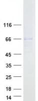 Human ACSM4 Protein (Recombinant Myc-DDK (Flag))