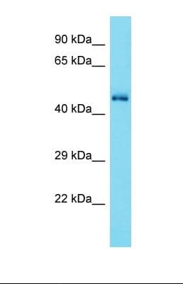 CDK15 / ALS2CR7 Antibody (aa51-100)