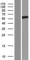 PRDM11 Protein (Over-Expression Lysate Myc-DDK (Flag))