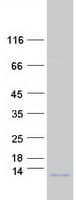Human COX8C Protein (Recombinant Myc-DDK (Flag))