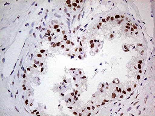 POLR2A / RNA polymerase II Antibody (aa1351-1614, clone OTI1E5)