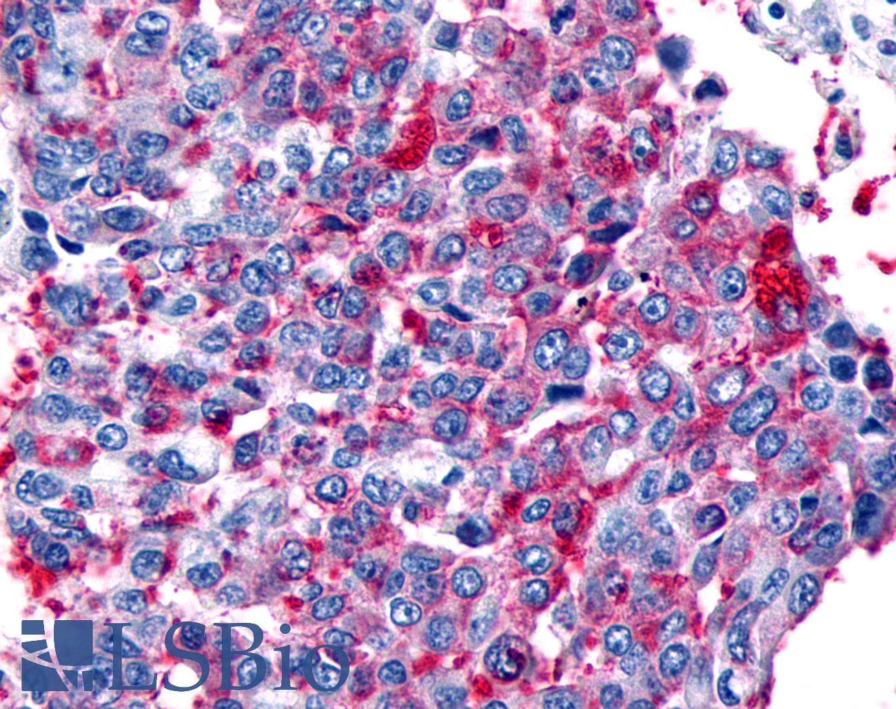 PathPlus™ FZD8 / Frizzled 8 Antibody (N-Terminus)