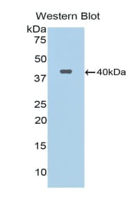 Calcitonin Antibody (aa26-136)