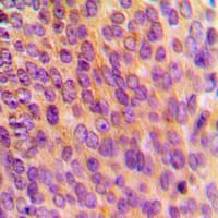 MRPL10 Antibody (C-Terminus)