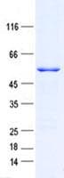 Human KRT73 / Keratin 73 Protein (Recombinant His, N-Terminal)