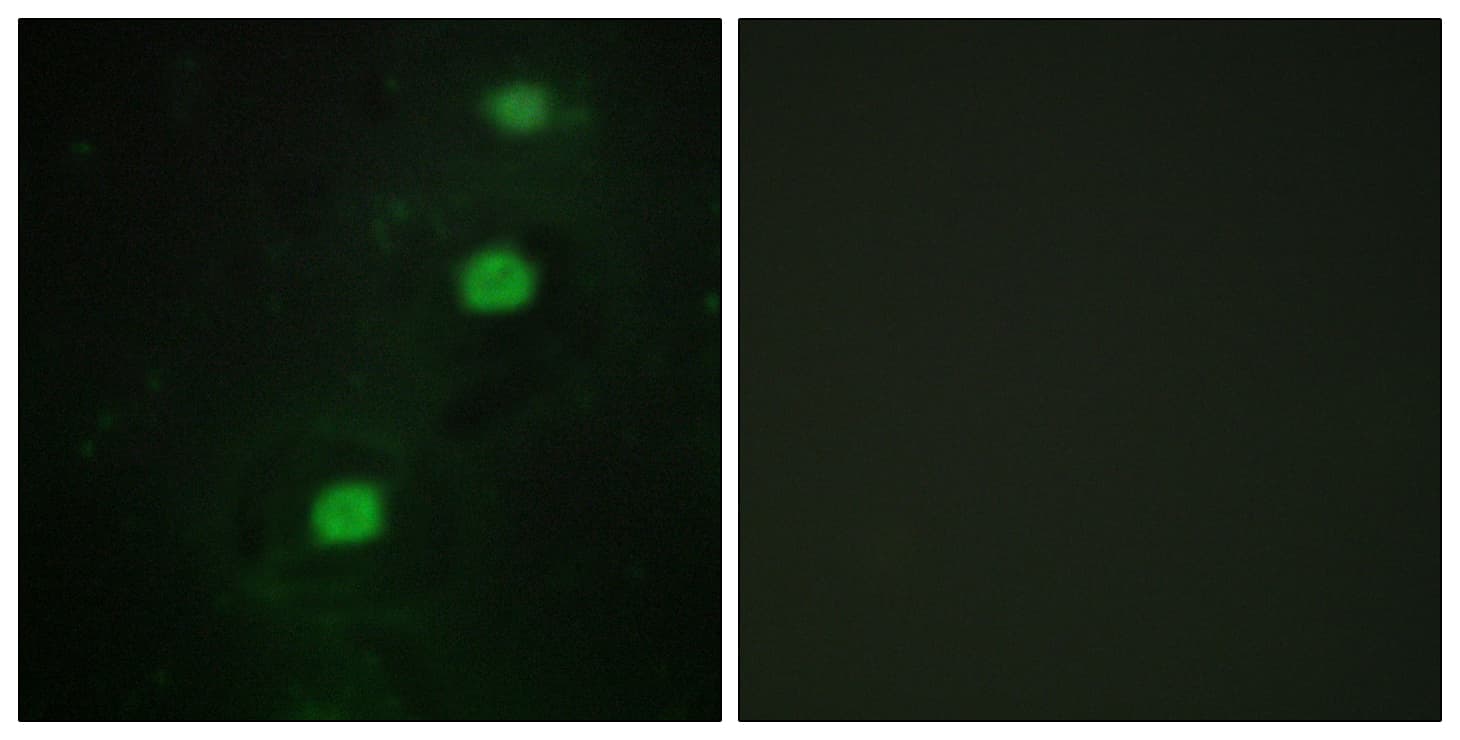 Polyclonal Rabbit anti-Human CDK20 / CCRK Antibody (aa31-80, IF, WB)