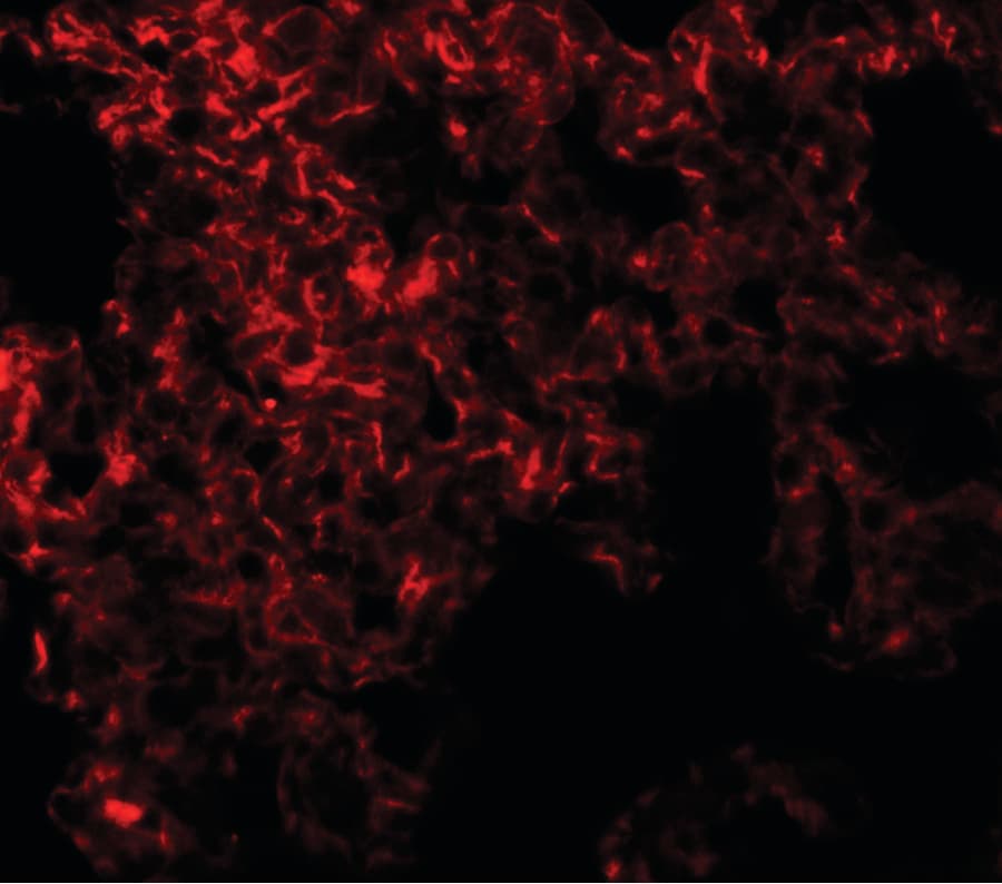 Polyclonal Rabbit anti-Human NETO1 Antibody (IHC, IF, WB)