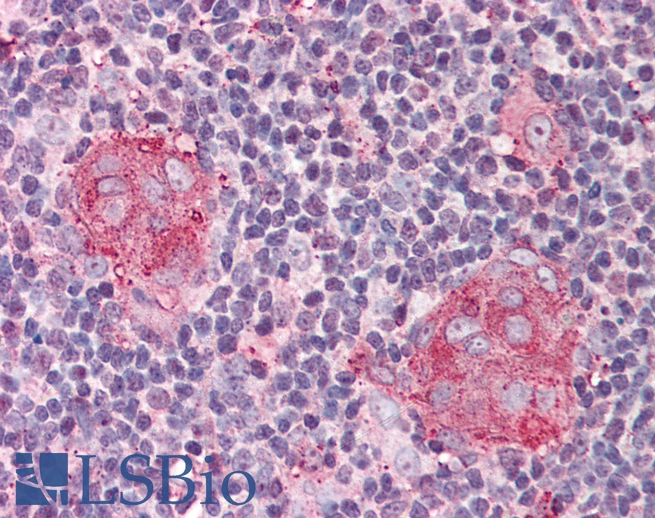 IHC-plus™ IL21 Receptor Antibody