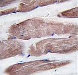PIK3C3 / VPS34 Antibody (aa9-41)