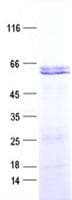 Human SMAD5 Protein (Recombinant His, N-Terminal)