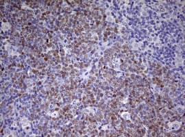 Monoclonal Mouse anti-Human CDCA7L Antibody (clone OTI6C6, aa1-337, IHC, WB)