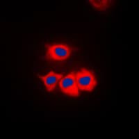 Polyclonal Rabbit anti-Human SSBP1 / mtSSB Antibody (C-Terminus, IHC, IF, WB)