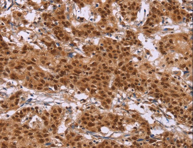 CTNNBL1 / NAP Antibody