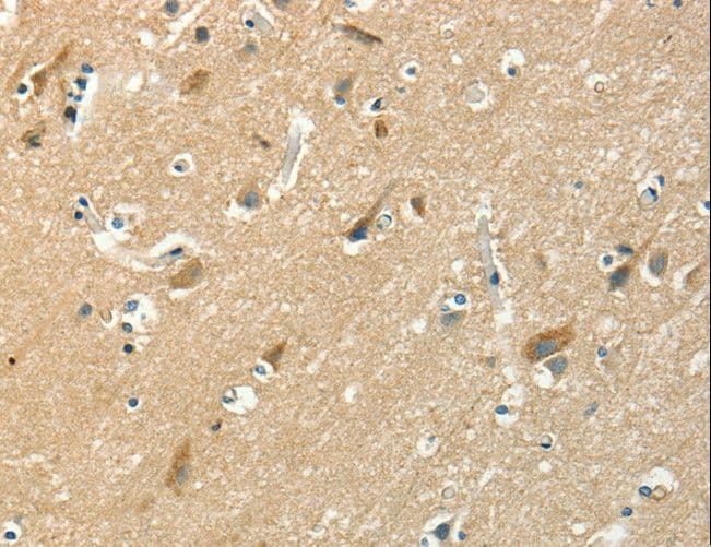 ASAH2 Antibody
