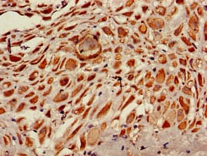 RPS6KA5 / MSK1 Antibody