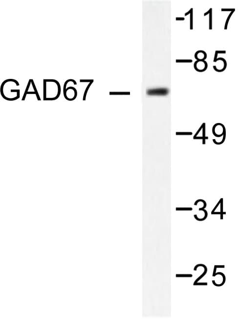 GAD1 / GAD67 Antibody (Ala492)