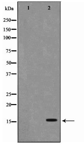 PFDN1 Antibody