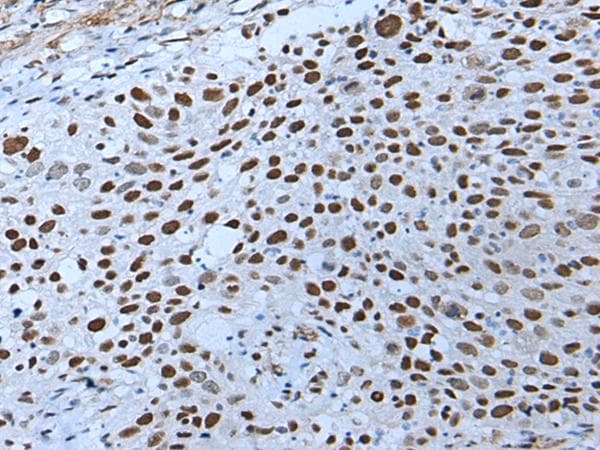 ZNHIT3 Antibody
