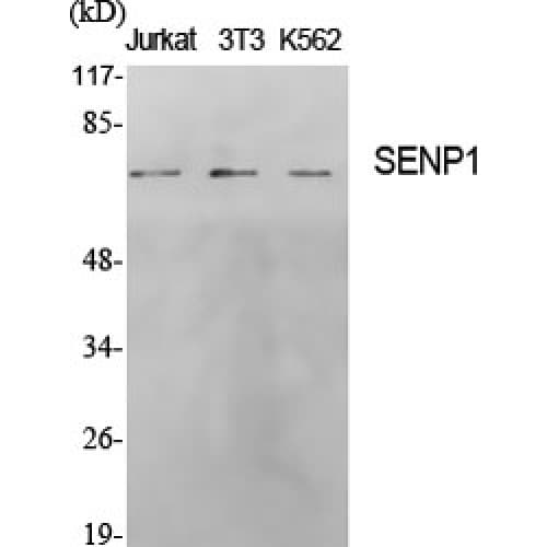Polyclonal Rabbit anti-Human SENP1 Antibody (1-80 aa, N-terminal, IHC, WB)