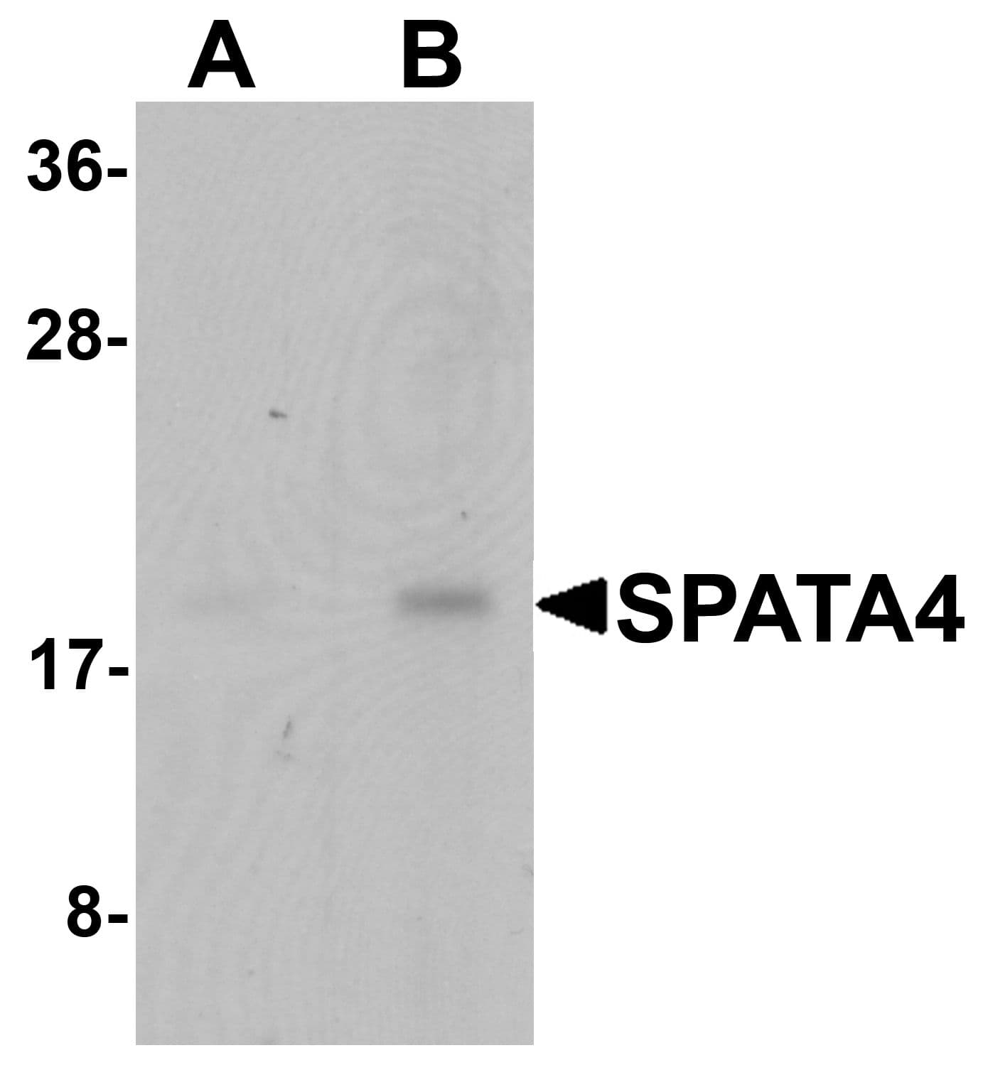 Polyclonal Rabbit anti-Human SPATA4 Antibody (IHC, IF, WB)
