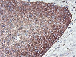 PFKP Antibody (clone OTI1D6)