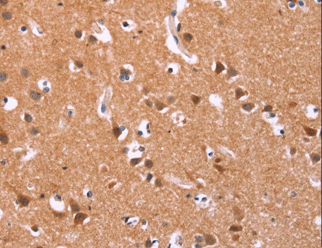 Polyclonal Rabbit anti-Human ICAM5 / ICAM-5 Antibody (IHC, WB)