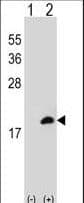 CLP / COTL1 Antibody (aa115-142)