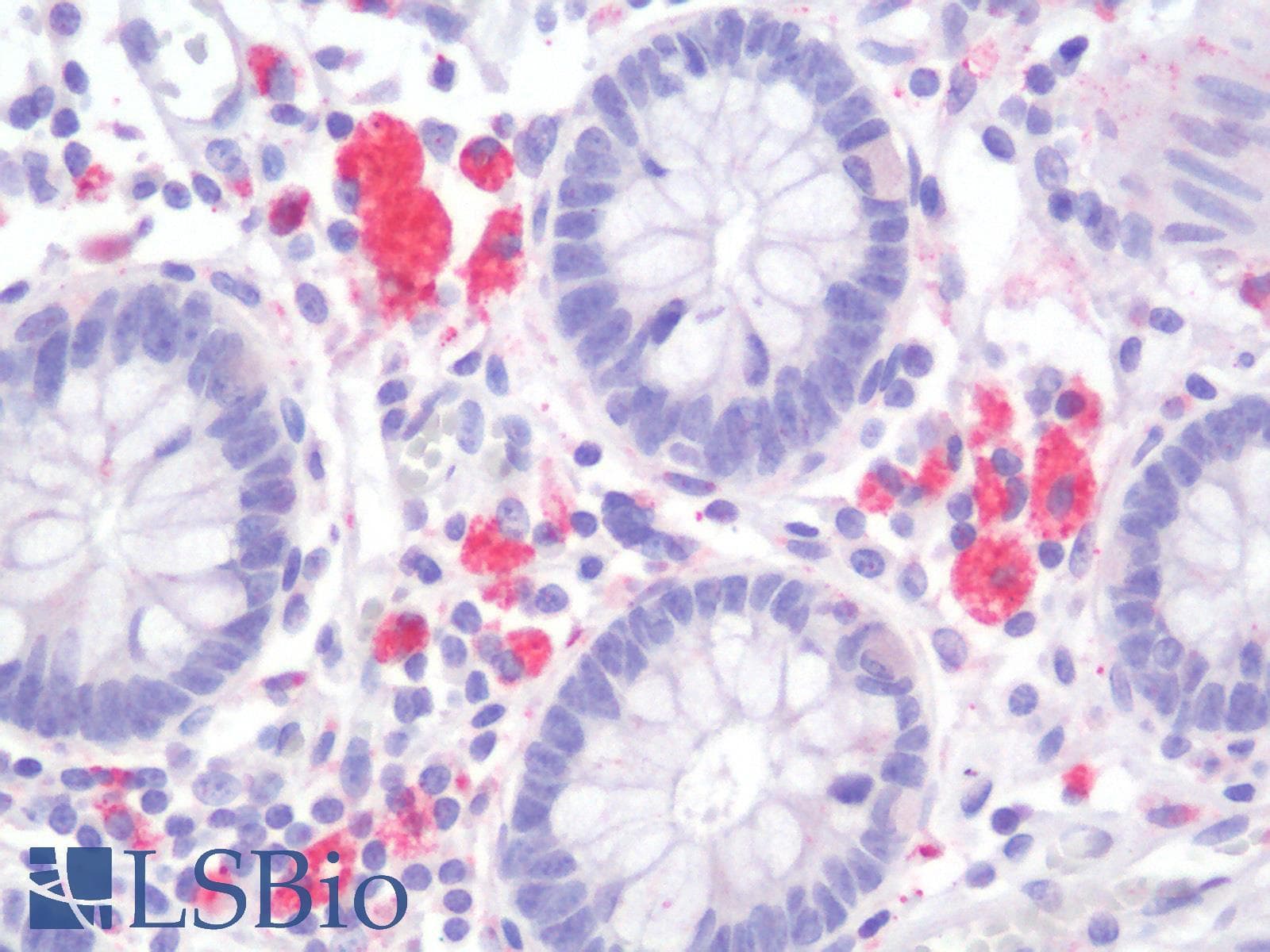 IHC-plus™ Polyclonal Rabbit anti-Human LAG3 Antibody (IHC)