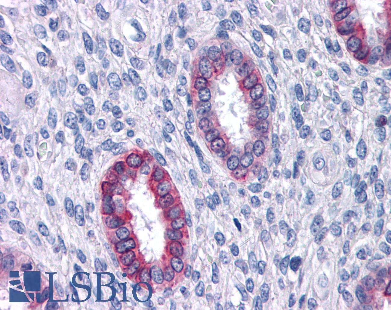 IHC-plus™ Polyclonal Rabbit anti-Human Renal Dipeptidase / DPEP1 Antibody (Internal, IHC)