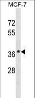 MRPL2 Antibody (aa236-264)