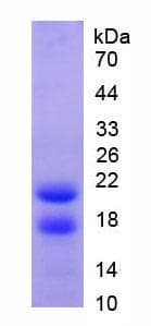 Human PRTN3 / Myeloblastin Protein (Recombinant His)